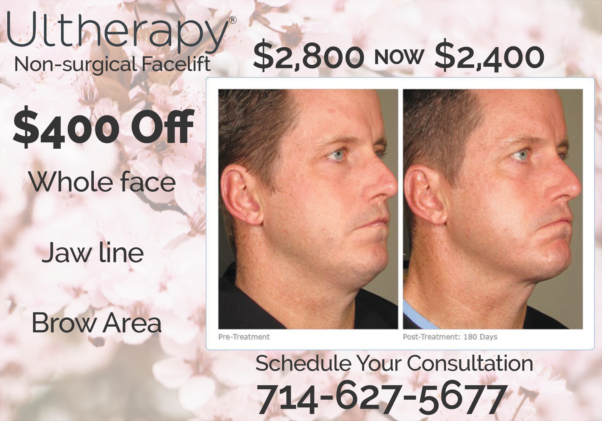 clinical-aesthetics-ultherapy-2