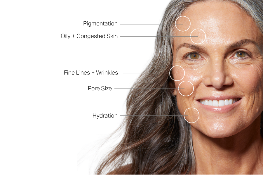 hydrafacial information
